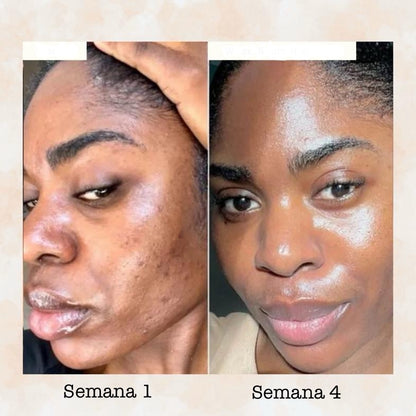 Pastilla Ácido Kójico Bellure PureSkin®