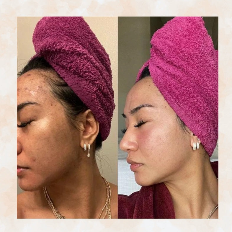 Pastilla Ácido Kójico Bellure PureSkin®