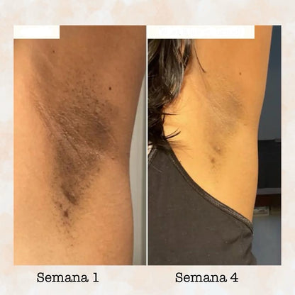 Pastilla Ácido Kójico Bellure PureSkin®